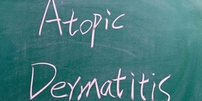 Hidup dengan Dermatitis Atopik (AD)