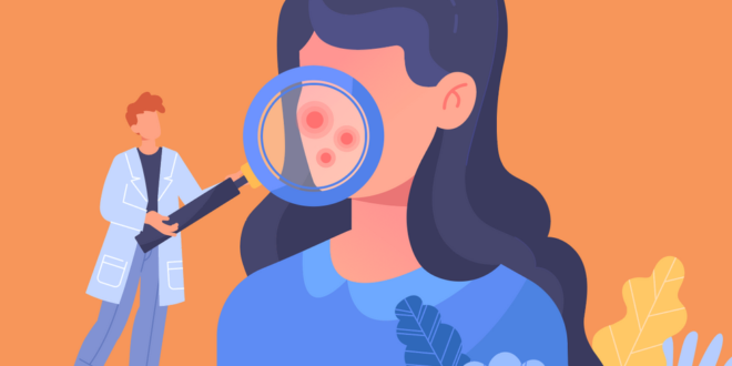 Bagaimana psoriasis berubah seiring bertambahnya usia?