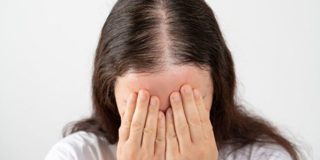 Rambut rontok pada wanita – Wanita Sehat