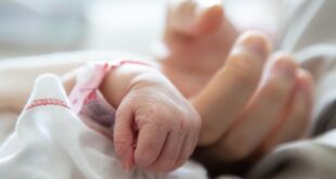 Bisakah tinggal di Amerika Serikat meningkatkan risiko kelahiran prematur?