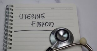 Bagaimana memilih asuransi kesehatan ketika Anda memiliki fibroid