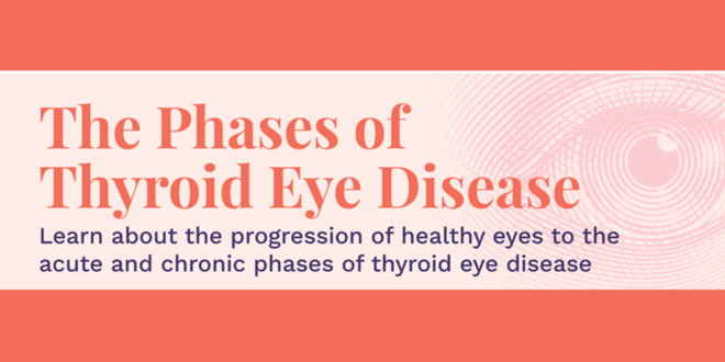 Tahapan penyakit mata tiroid