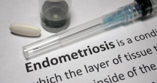 Fakta cepat: Apa yang perlu Anda ketahui tentang endometriosis