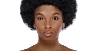 Nasihat dokter kulit untuk wanita kulit berwarna