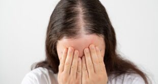 Rambut rontok pada wanita – Wanita Sehat