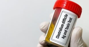 Apa yang perlu Anda ketahui tentang Clostridium difficile