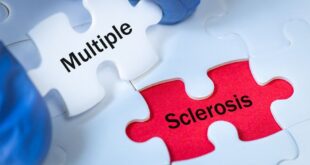 Pertanyaan yang sering diajukan tentang multiple sclerosis